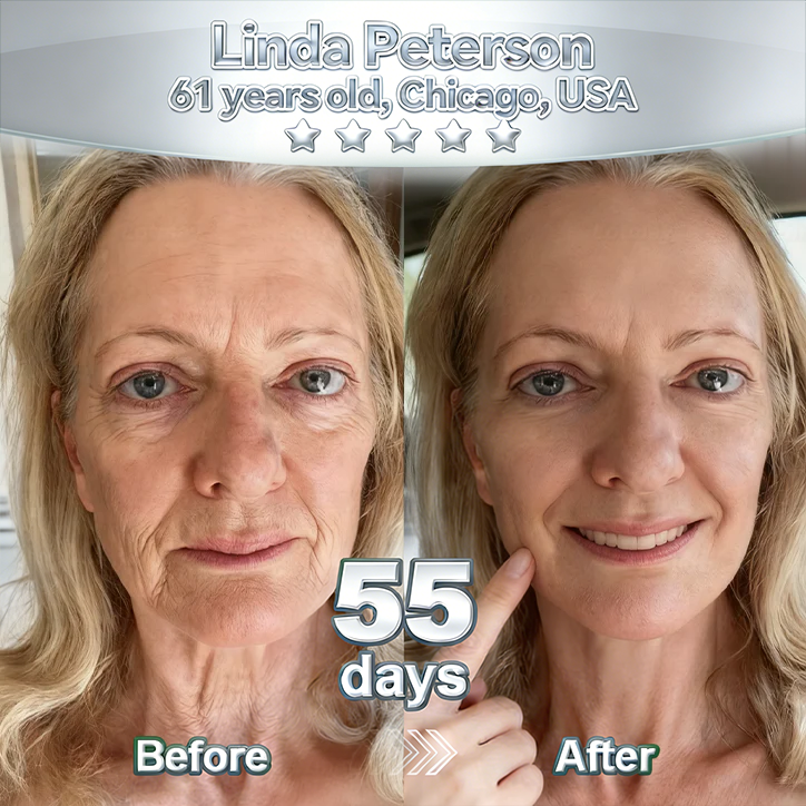 𝑷𝒖𝒓𝒆𝒍𝒖𝒙𝒐® 🇦🇺 Stem Cell–Inspired & GHK-Cu Powered Wrinkle-Refining Serum（Advanced Anti-Aging for Timeless, Radiant Skin）