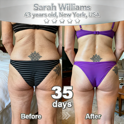 𝑷𝒖𝒓𝒆𝒍𝒖𝒙𝒐® 🇦🇺 Stem Cell–Inspired & GHK-Cu Powered Wrinkle-Refining Serum（Advanced Anti-Aging for Timeless, Radiant Skin）