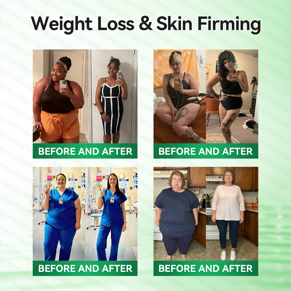 [Doctor-backed / Clinical support] 🇦🇺 𝙋𝙪𝙧𝙚𝙡𝙪𝙭𝙤® L-Carnitine × Retinol | Slimming & Firming 2-in-1 Nano Microneedle Patch 🔥 Obesity, Diabetes, Sleep Apnea, And Joint Issues👩‍⚕️