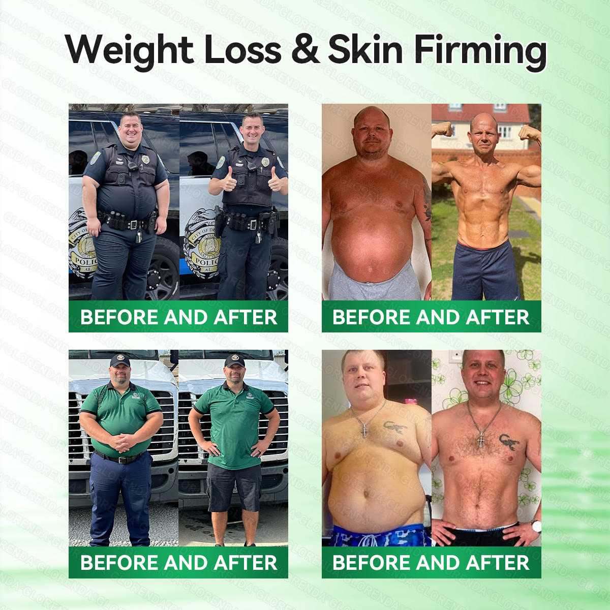 [Doctor-backed / Clinical support] 🇦🇺 𝙋𝙪𝙧𝙚𝙡𝙪𝙭𝙤® L-Carnitine × Retinol | Slimming & Firming 2-in-1 Nano Microneedle Patch 🔥 Obesity, Diabetes, Sleep Apnea, And Joint Issues👩‍⚕️