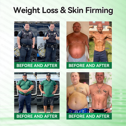 [Doctor-backed / Clinical support] 🇦🇺 𝙋𝙪𝙧𝙚𝙡𝙪𝙭𝙤® L-Carnitine × Retinol | Slimming & Firming 2-in-1 Nano Microneedle Patch 🔥 Obesity, Diabetes, Sleep Apnea, And Joint Issues👩‍⚕️