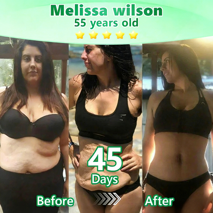 [Doctor-backed / Clinical support] 🇦🇺 𝙋𝙪𝙧𝙚𝙡𝙪𝙭𝙤® L-Carnitine × Retinol | Slimming & Firming 2-in-1 Nano Microneedle Patch 🔥 Obesity, Diabetes, Sleep Apnea, And Joint Issues👩‍⚕️