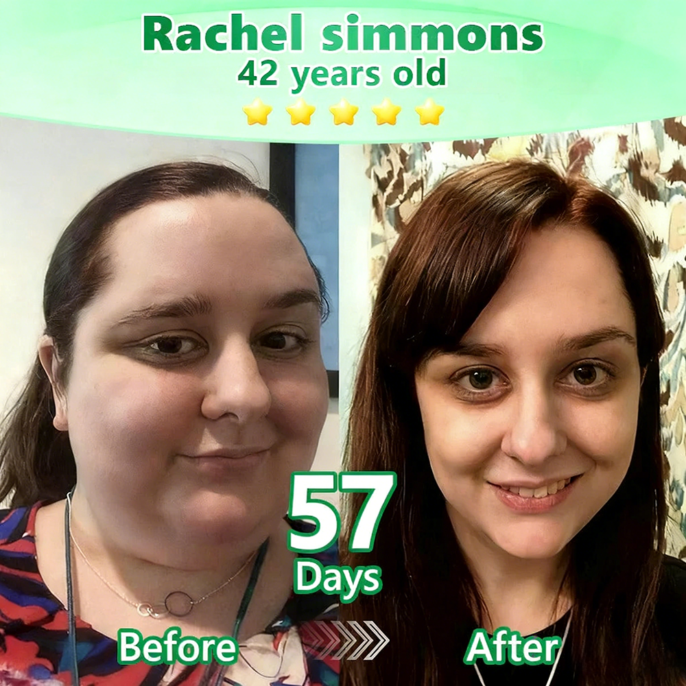 [Doctor-backed / Clinical support] 🇦🇺 𝙋𝙪𝙧𝙚𝙡𝙪𝙭𝙤® L-Carnitine × Retinol | Slimming & Firming 2-in-1 Nano Microneedle Patch 🔥 Obesity, Diabetes, Sleep Apnea, And Joint Issues👩‍⚕️