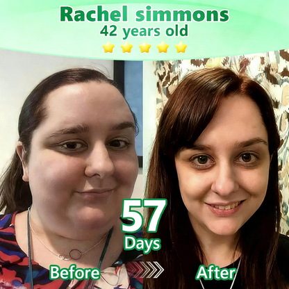 [Doctor-backed / Clinical support] 🇦🇺 𝙋𝙪𝙧𝙚𝙡𝙪𝙭𝙤® L-Carnitine × Retinol | Slimming & Firming 2-in-1 Nano Microneedle Patch 🔥 Obesity, Diabetes, Sleep Apnea, And Joint Issues👩‍⚕️