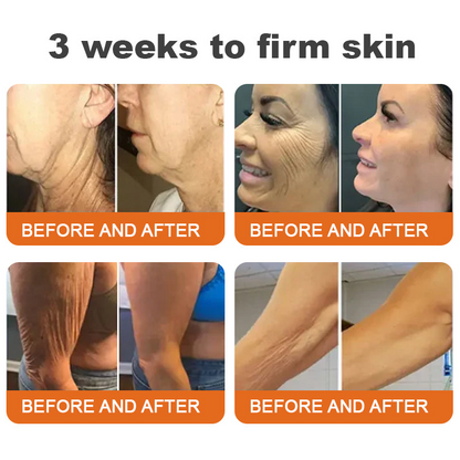 Made and Shipped from USA✨TLOPA® Botox Bee Venom Firming Serum Stick(🔥LAST DAY 70% OFF)💄