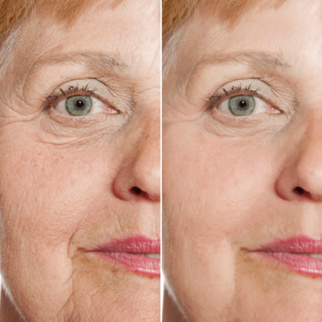 𝑷𝒖𝒓𝒆𝒍𝒖𝒙𝒐® 🇦🇺 Stem Cell–Inspired & GHK-Cu Powered Wrinkle-Refining Serum（Advanced Anti-Aging for Timeless, Radiant Skin）