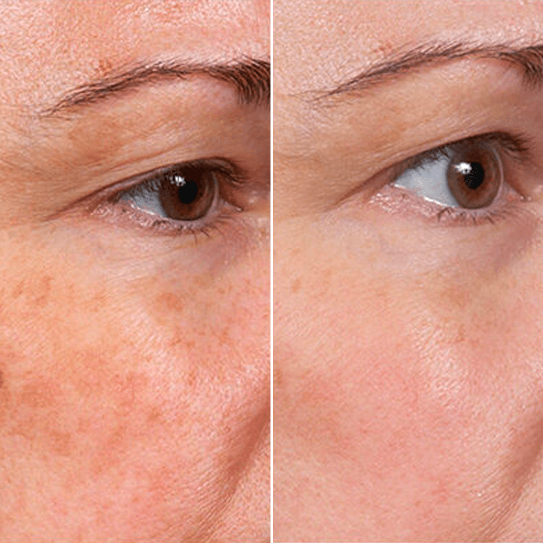 𝑷𝒖𝒓𝒆𝒍𝒖𝒙𝒐® 🇦🇺 Stem Cell–Inspired & GHK-Cu Powered Wrinkle-Refining Serum（Advanced Anti-Aging for Timeless, Radiant Skin）