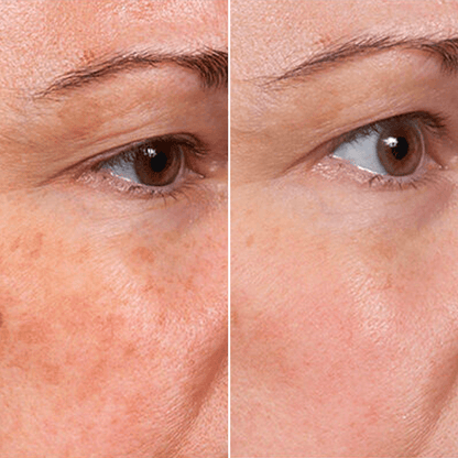 𝑷𝒖𝒓𝒆𝒍𝒖𝒙𝒐® 🇦🇺 Stem Cell–Inspired & GHK-Cu Powered Wrinkle-Refining Serum（Advanced Anti-Aging for Timeless, Radiant Skin）